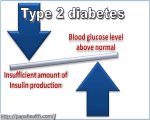 diabetes-meter-comparison-home-type-ukn-2-remedies-for-c41