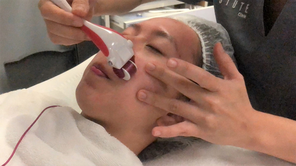 #PamperWithKye: I Tried Cryo Facial For The First Time