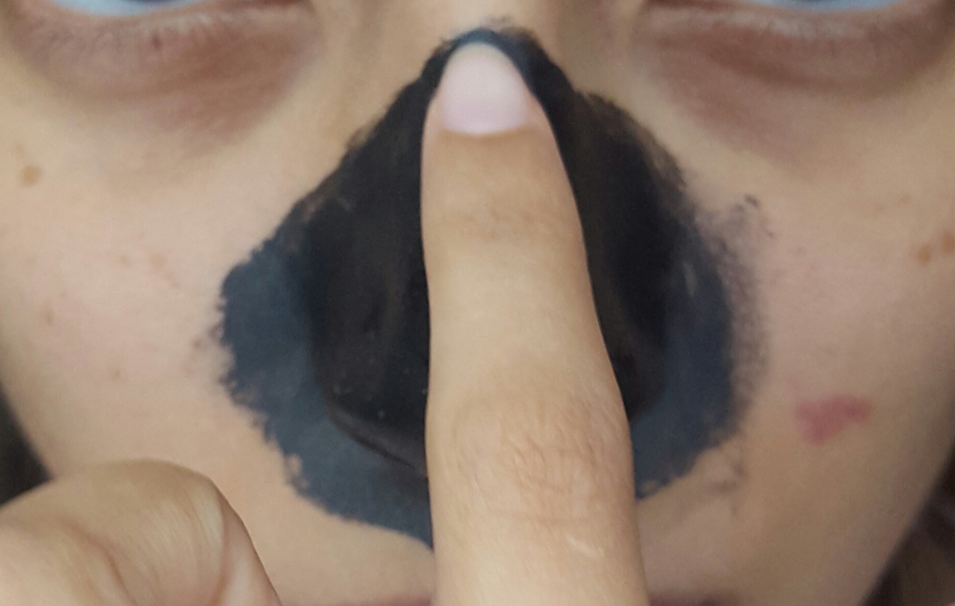 blackhead removal review
