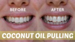 whiter teeth coconut oil