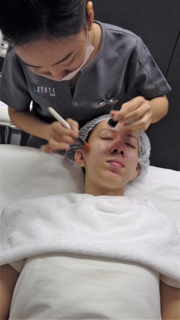 Tried & Tested: Astute Clinic's Astute Quintessential Facial-Pamper.my
