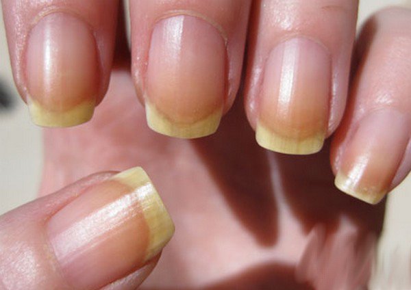 3 Things Your Nails Say About You-Pamper.my